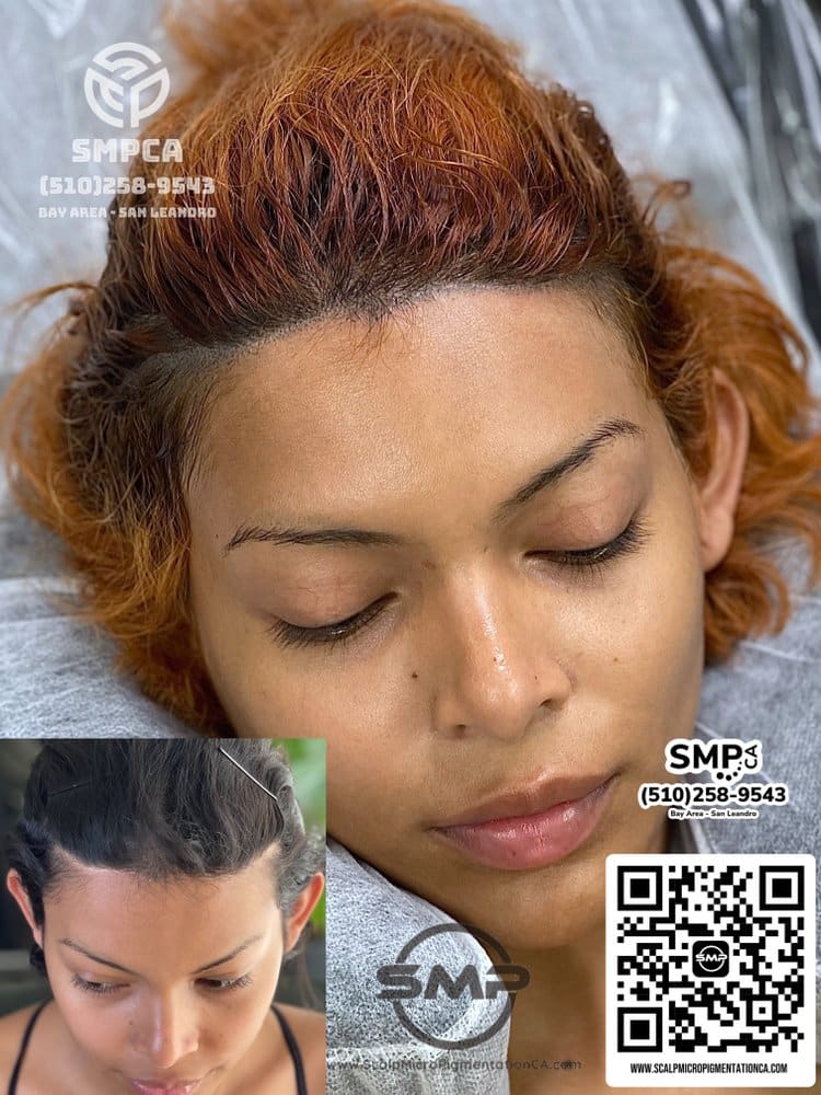 SMPCA scalp micropigmentation transformation 33 by Joe V. Nguyen, San Lorenzo CA