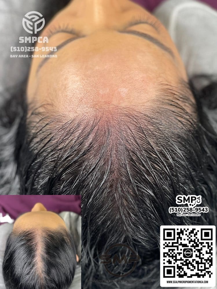 SMPCA scalp micropigmentation transformation 42 by Joe V. Nguyen, San Lorenzo CA