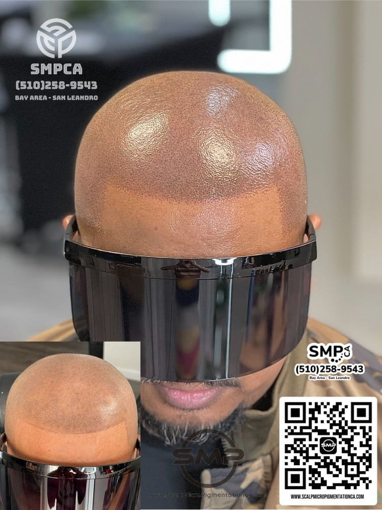 SMPCA scalp micropigmentation transformation 69 by Joe V. Nguyen, San Lorenzo CA